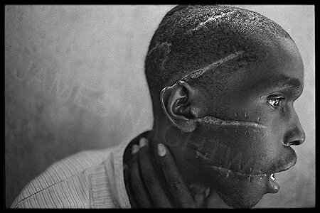 James Nachtwey: Rwanda, 1994